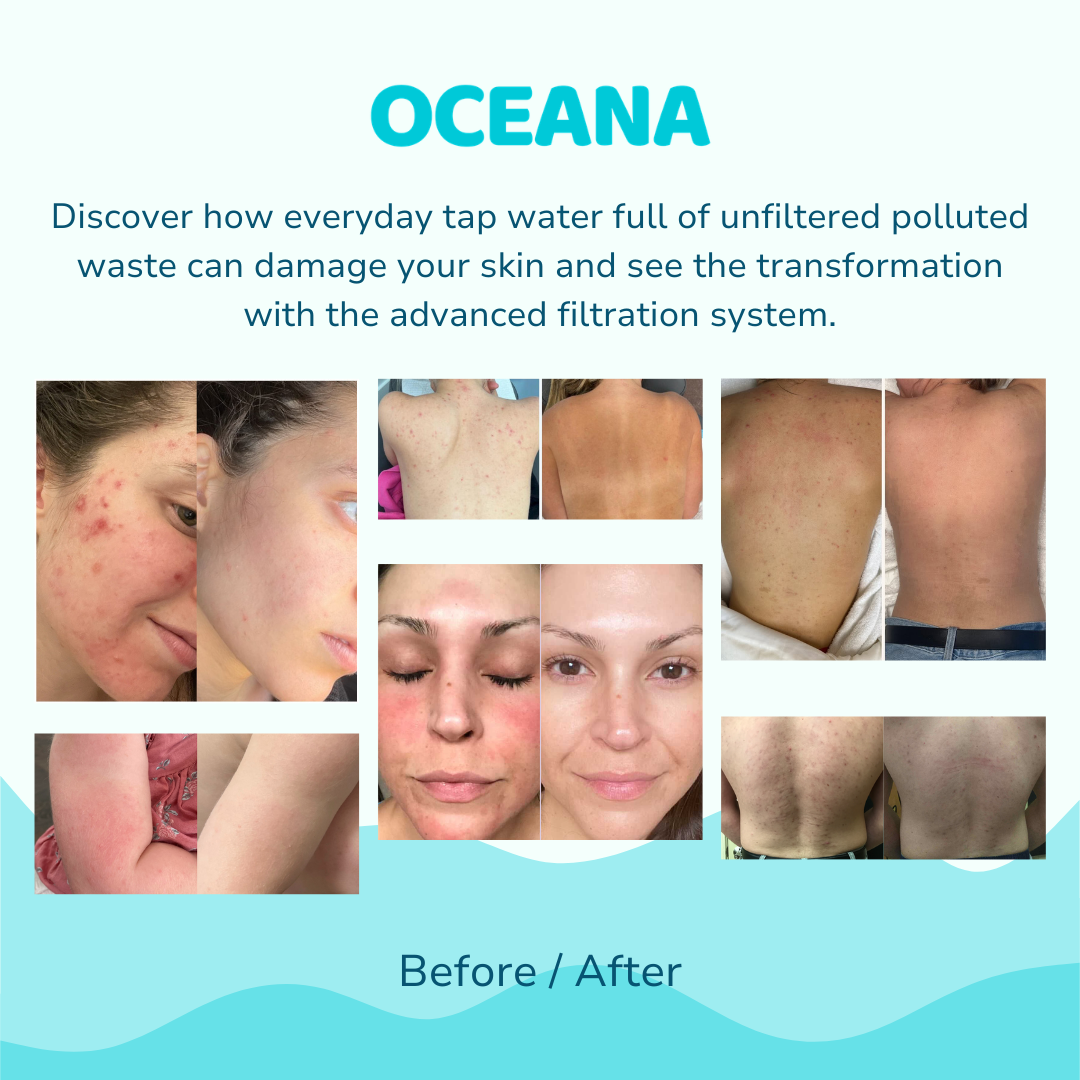 Oceana Filtered Showerhead